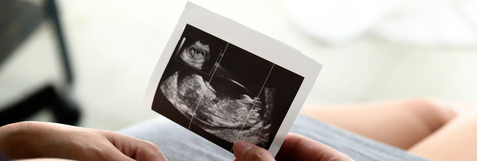 गर्भ में शिशु की हलचल कब शुरू होती है? जानें हर स्टेज का महत्व